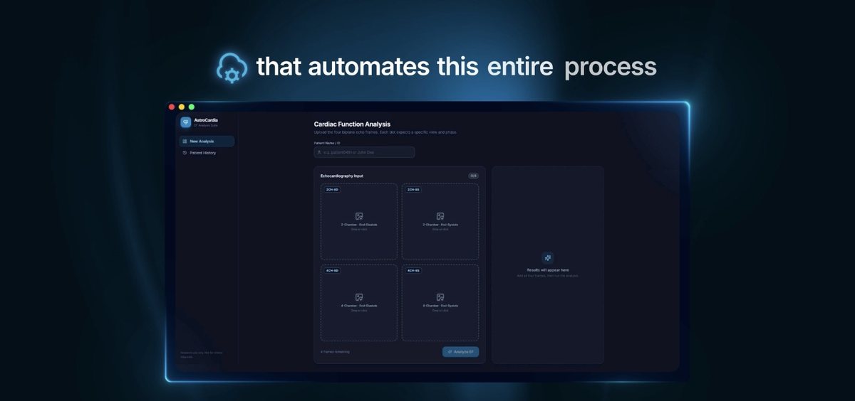 AstroCardia : écran Application
